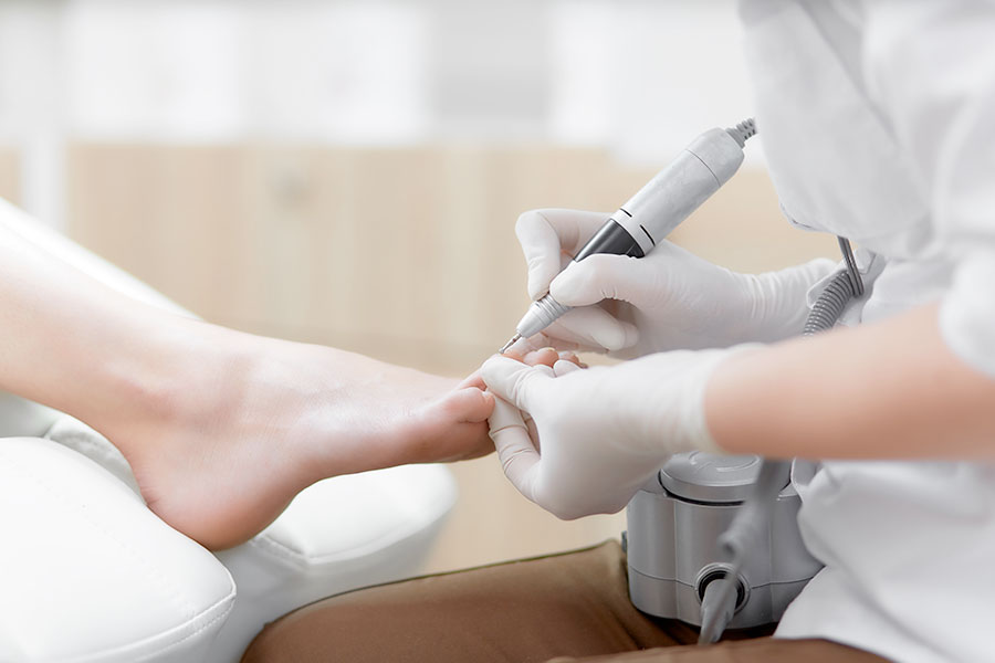 epilation laser definitive